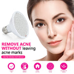 Beauty Lamp for Anti-acne, Blemish Removal and Skin Rejuvenation