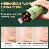 Herbal Acne Treatment Toner, Lifts the Skin, Removes Acne and Reduces Acne Marks